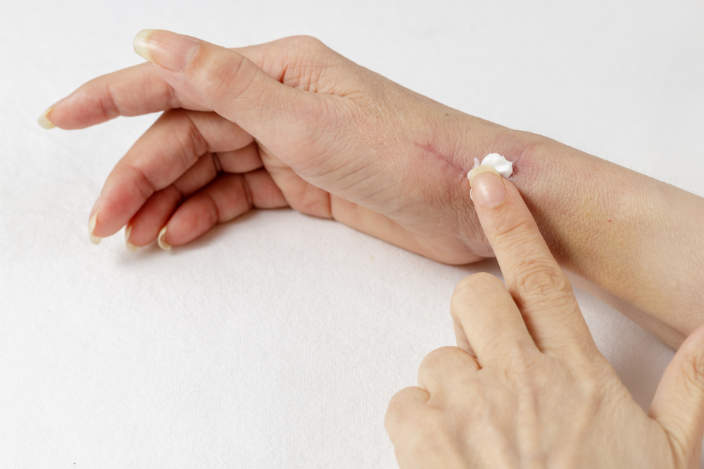 Cách dùng gel Dermatix với các loại sẹo đều tương tự nhau