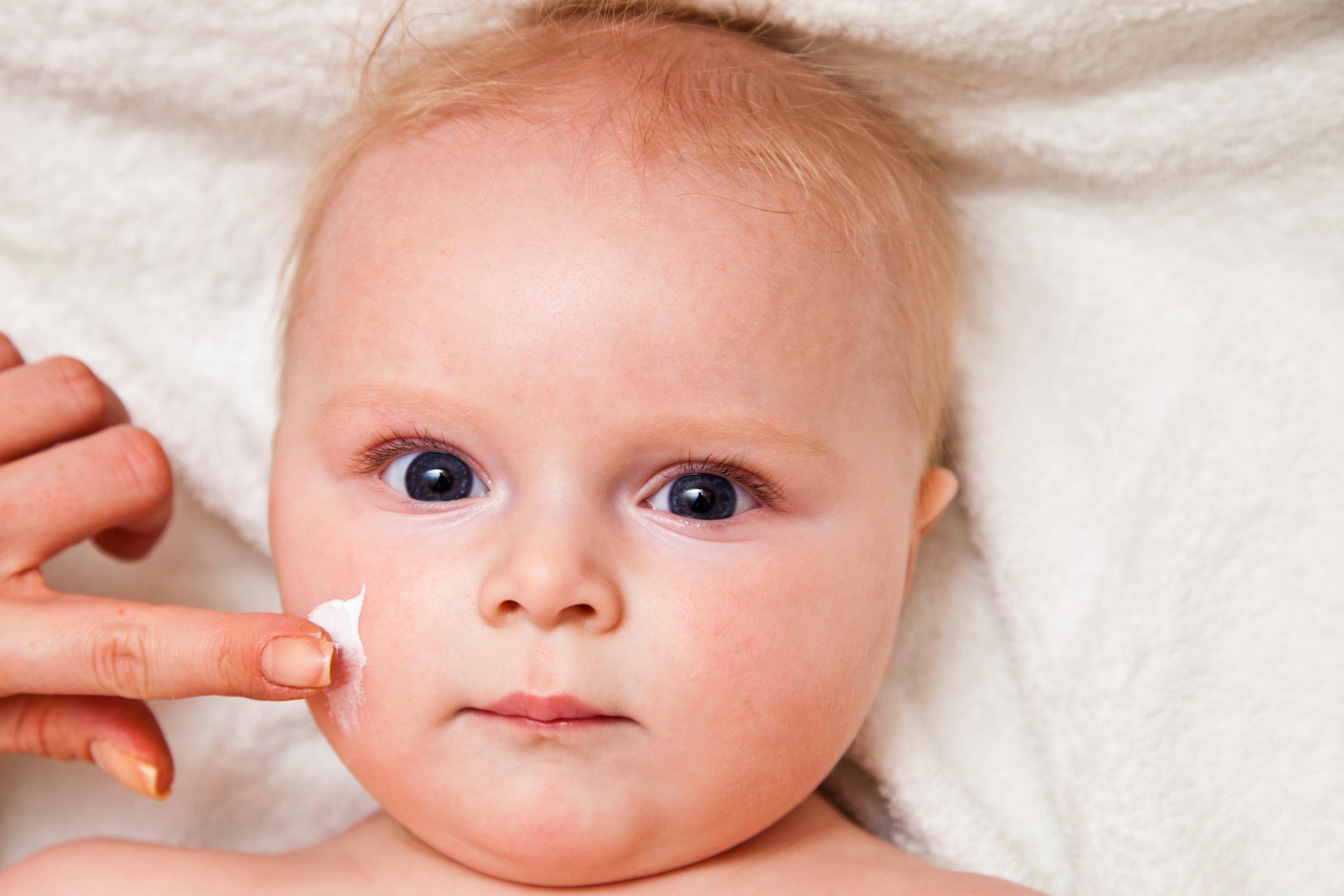 Cần lưu ý khi dùng kem trị sẹo Contractubex lên làn da em bé hay da quá nhạy cảm